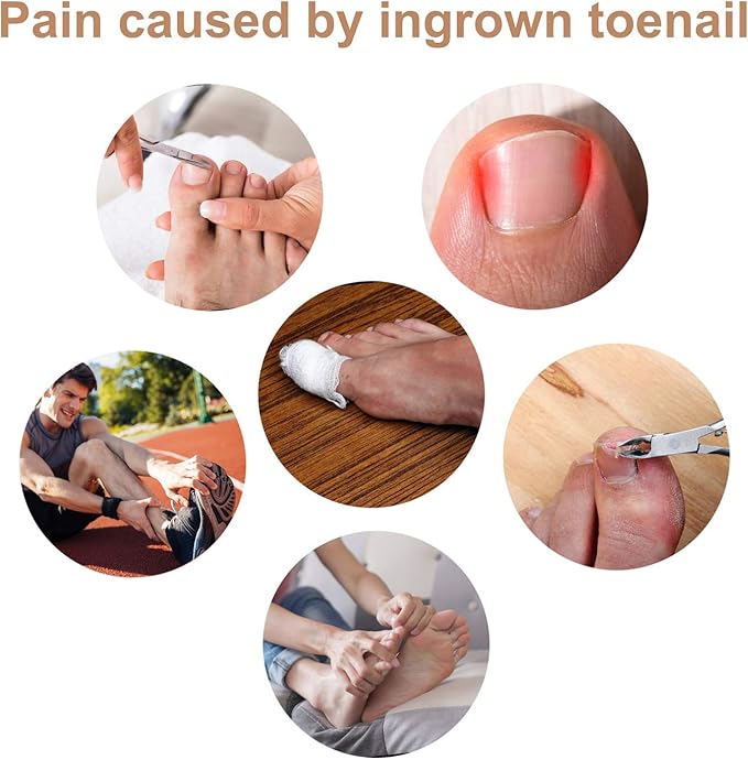 50x Toe Ingrown Nail Correction Patch Glue Free Toenail Sticker Foot Care