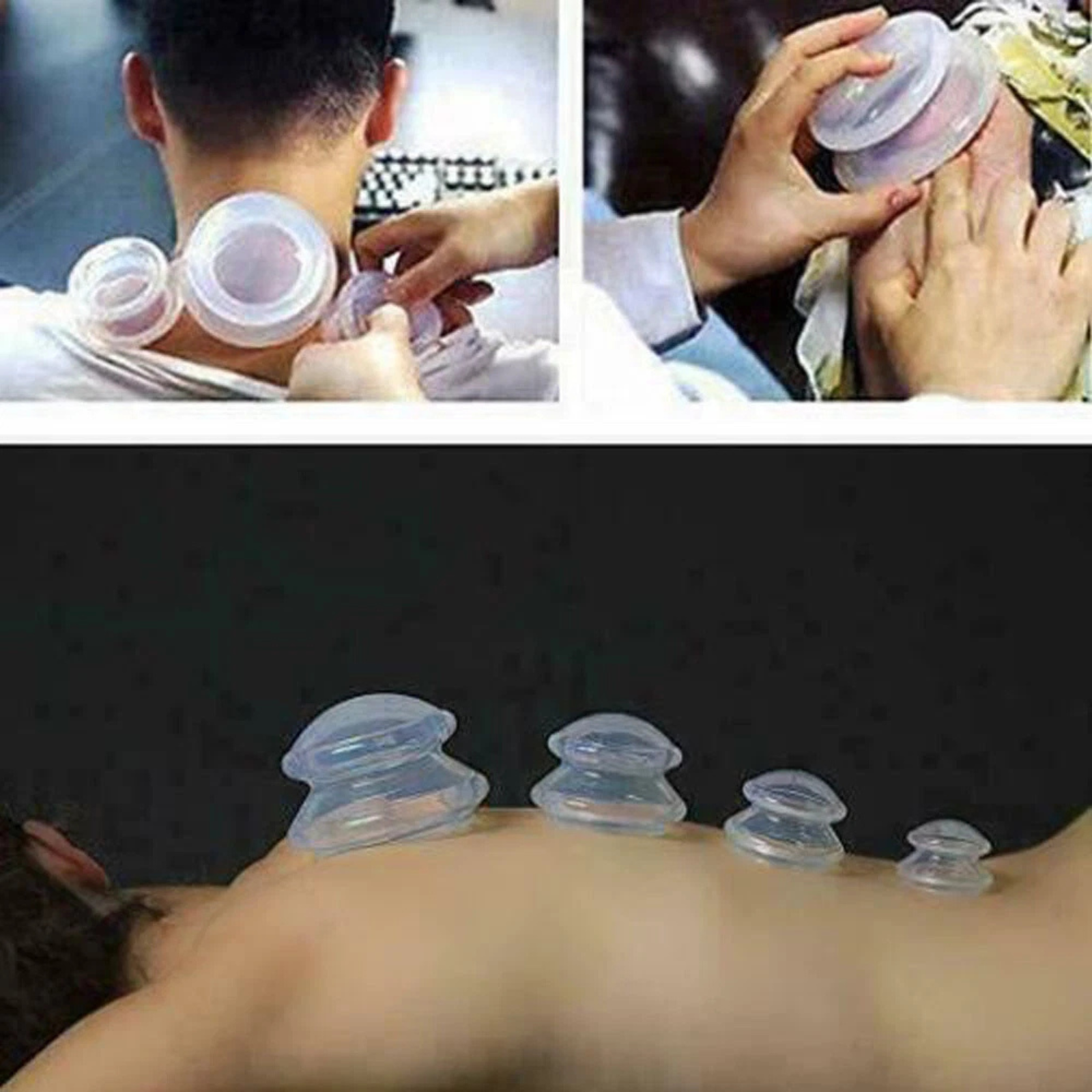 Anti Cellulite Medical Silicone Vacuum Clear Cupping Massage 5x