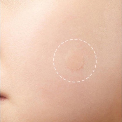 144Pcs Quick Effective Mole Removal Patches Skin Tag Remover Pad Sticker