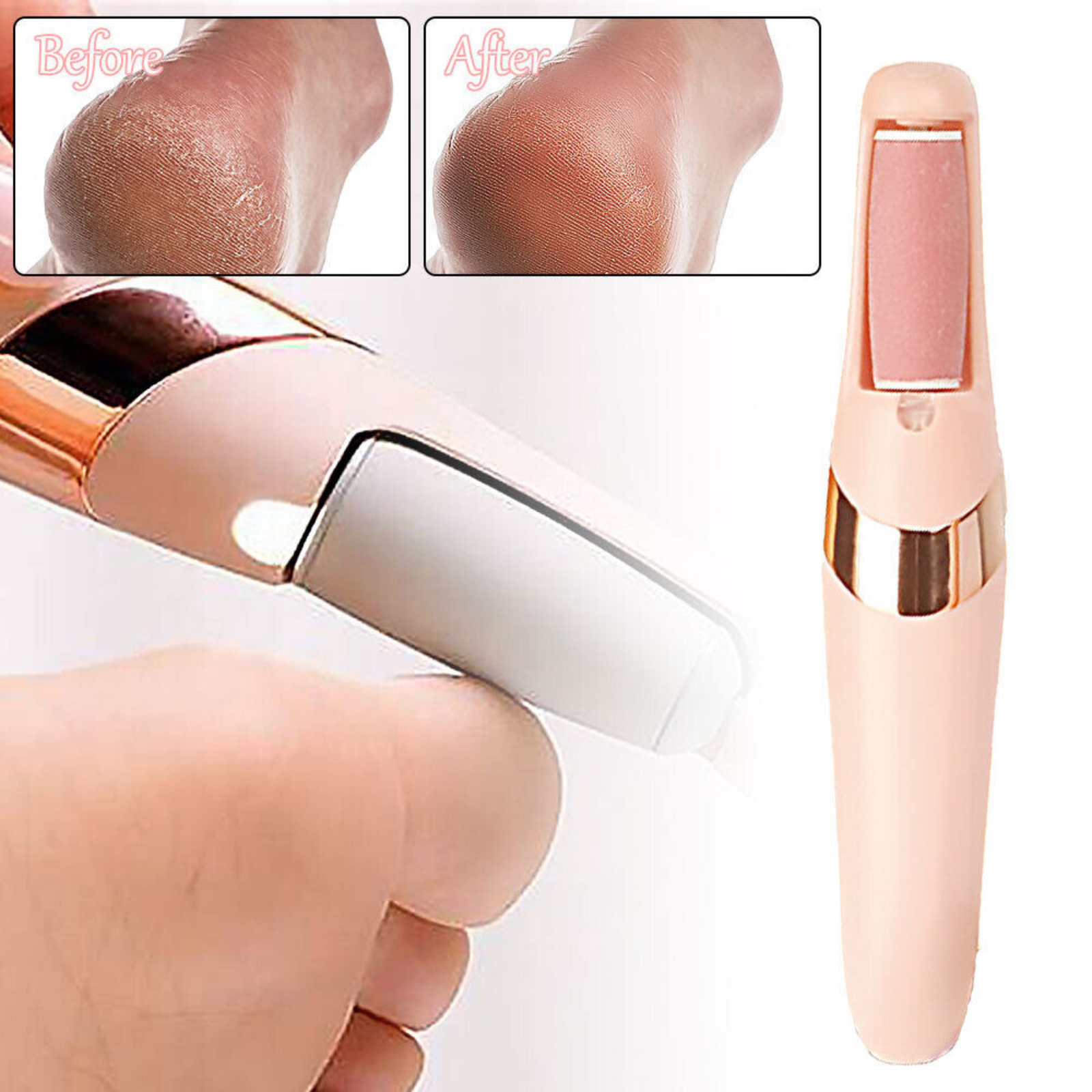 Foot Grinder File Vacuum Hard Portable USB Electric Skin Callus Remover Machine