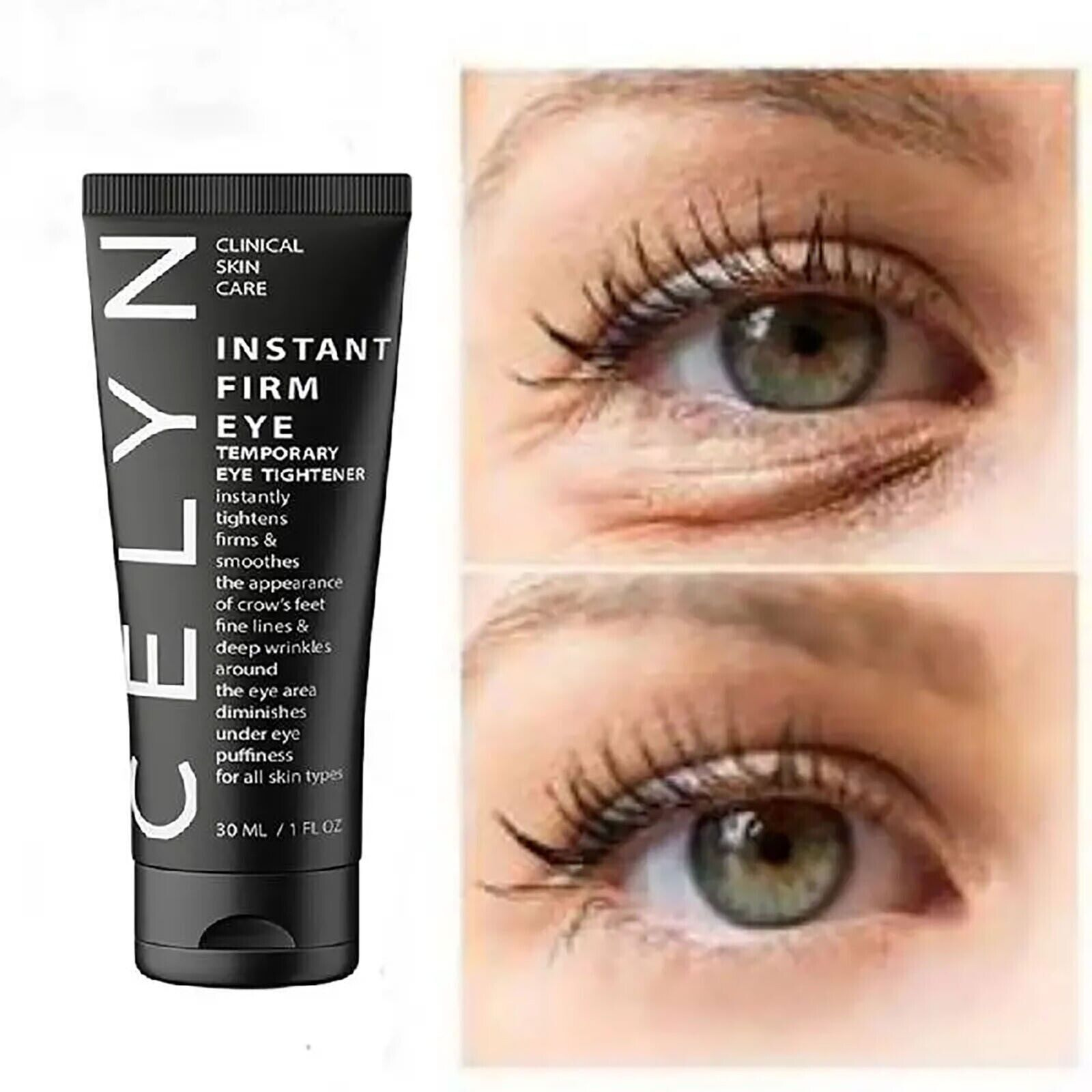 Best Celyn Eye Bag Cream 30ml Celyn Instant Firm Eye Tightener
