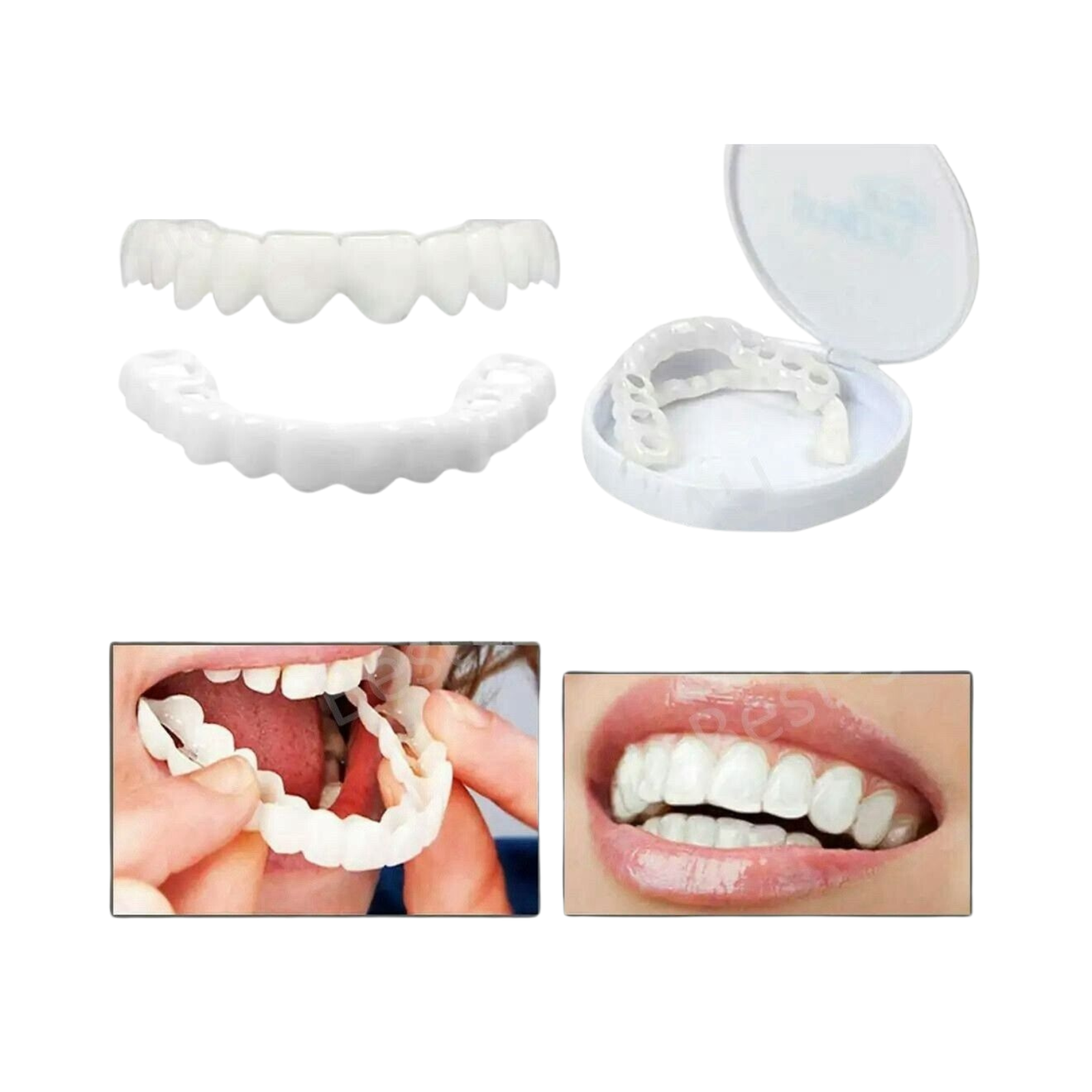 Dental Veneers Dentures Fake Tooth Smile Snap On Bottom Upper Lower False Teeth