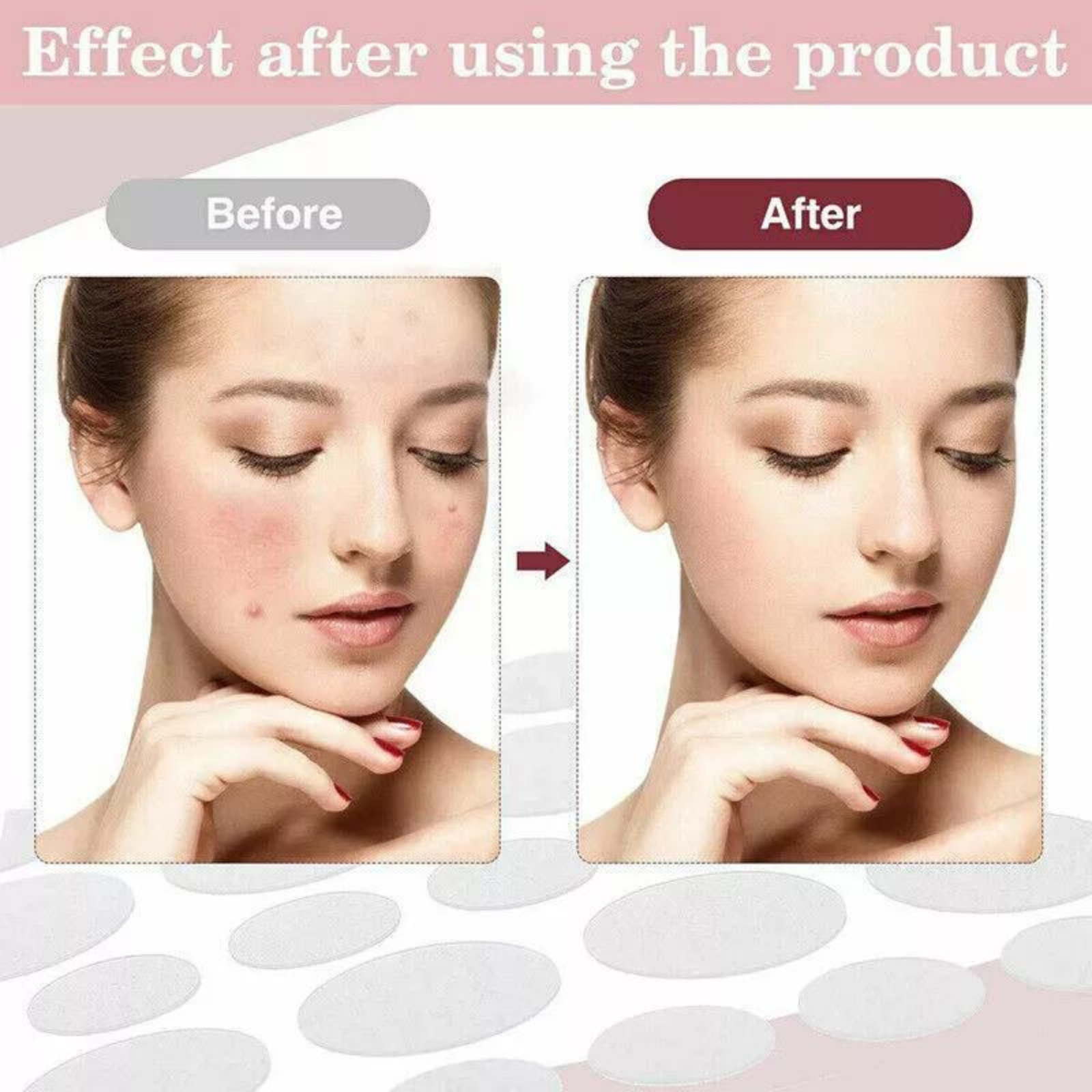 Skin Tags Pimple Remover Patch 36pcs Dermopatchy Acne Removal Facial Care Spot