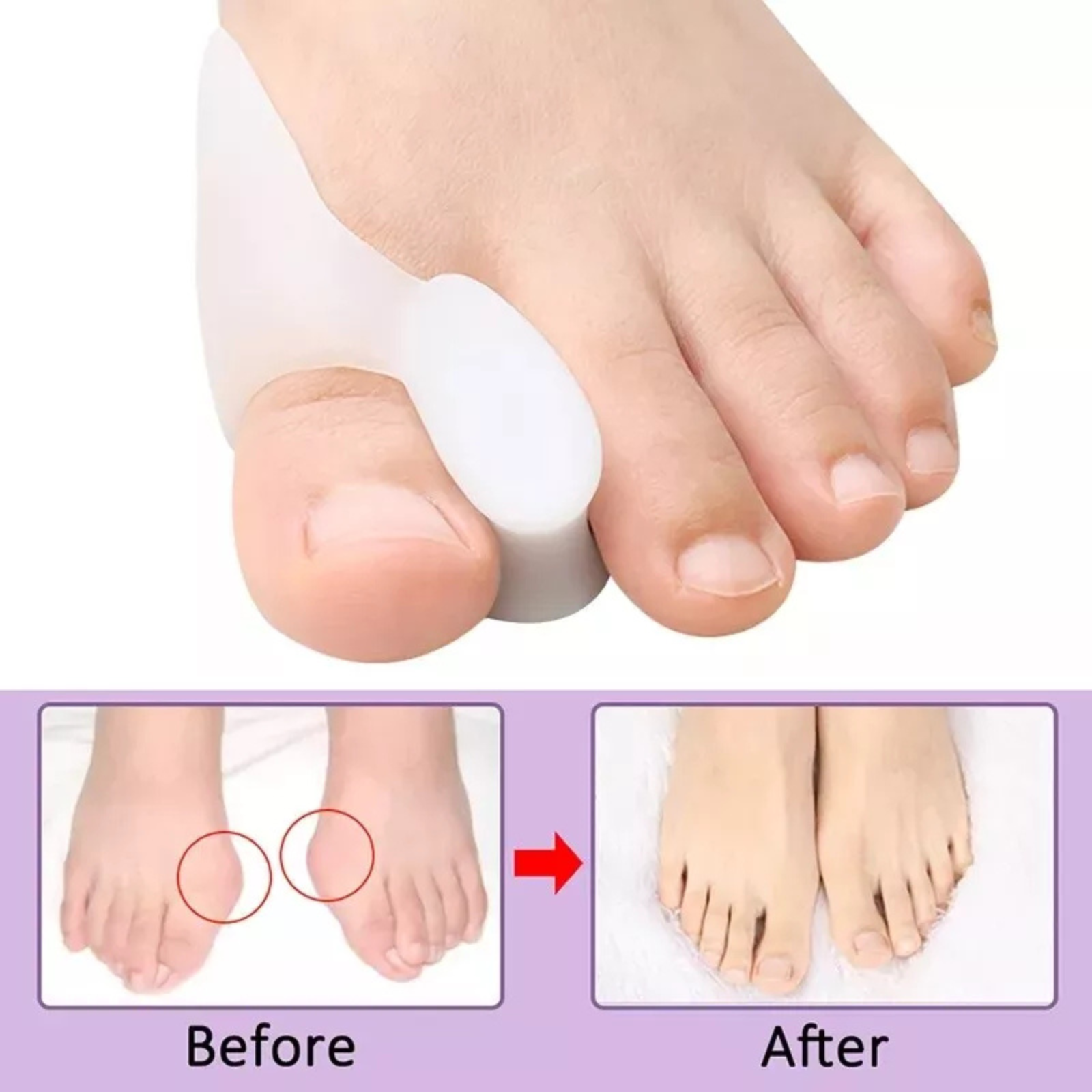 2x Gel Pain Relief Toe Separator Silicone Straightener Spreader Bunion Corrector