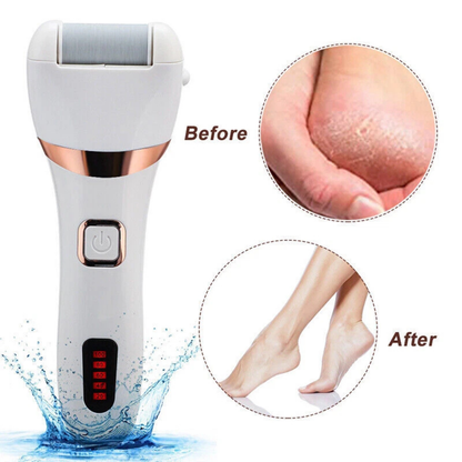 Electric Pedicure Care Kit Foot File Hard Dead Skin Removal Tool