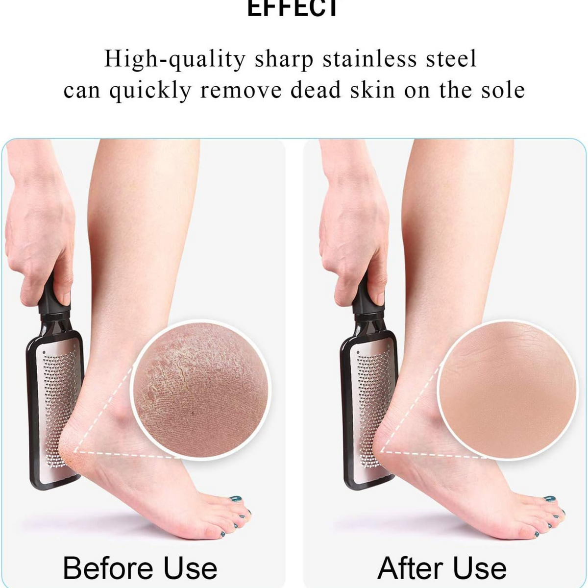 Black Foot Rasp File Callus Remover Stainless Steel Hard Dead Skin Scrubber