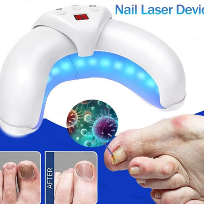 Blue Light Laser Device Nail Fungus Cleaning Treatment Tool for Toenails