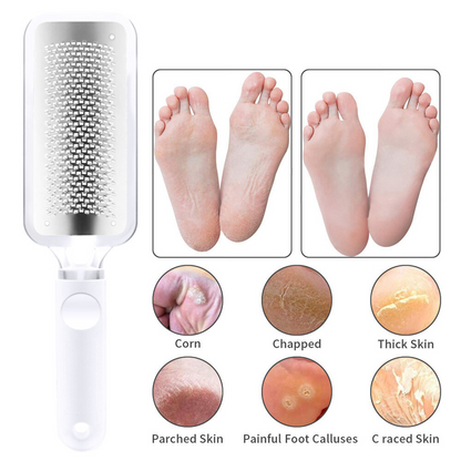 White Foot Rasp File Callus Remover Stainless Steel Hard Dead Skin Scrubber