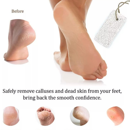 1x Pedicure Scrubber Callus Remover Foot Pumice Stone Feet Hard Dead Skin