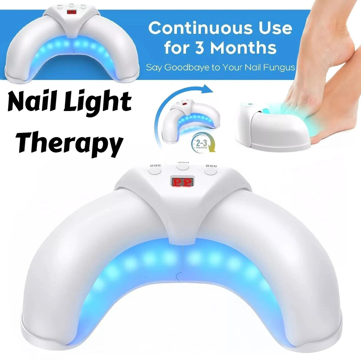Blue Light Laser Device Nail Fungus Cleaning Treatment Tool for Toenails