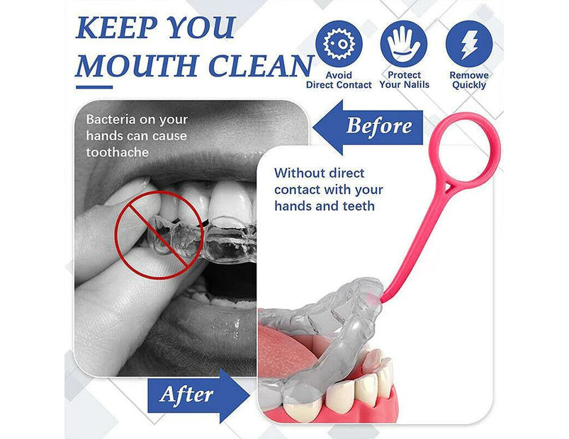 5x Invisible Braces Extractor Adult Child Aligner Removal Tool Tooth Hook