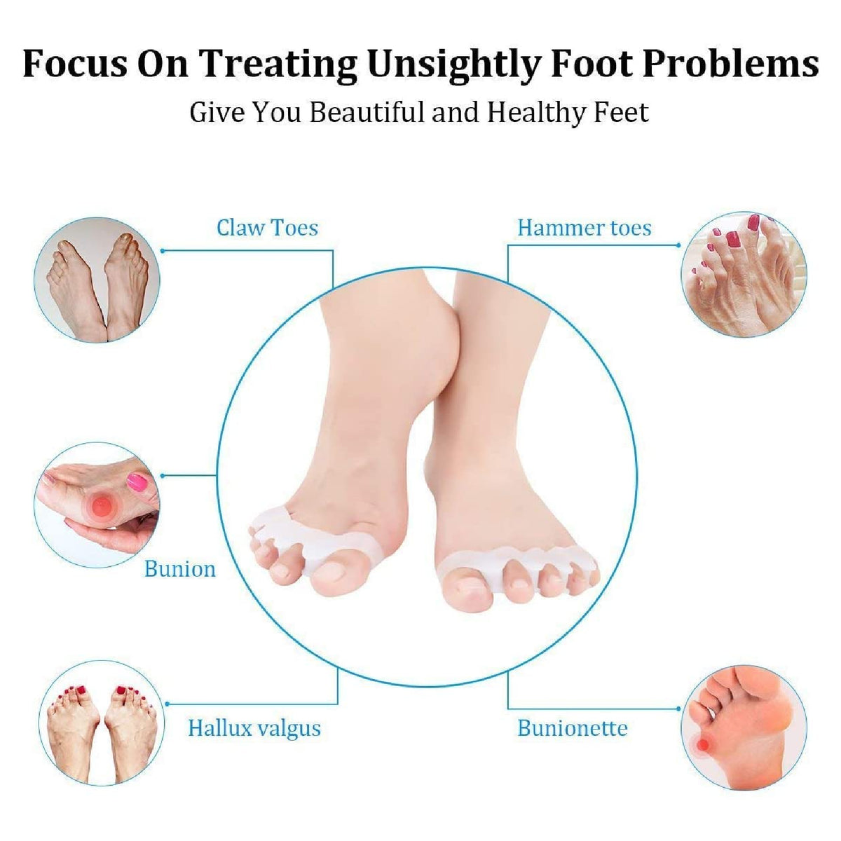 Silicone Gel Bunion Corrector Toe Separator Spreader Straightener Pain Relief 2x